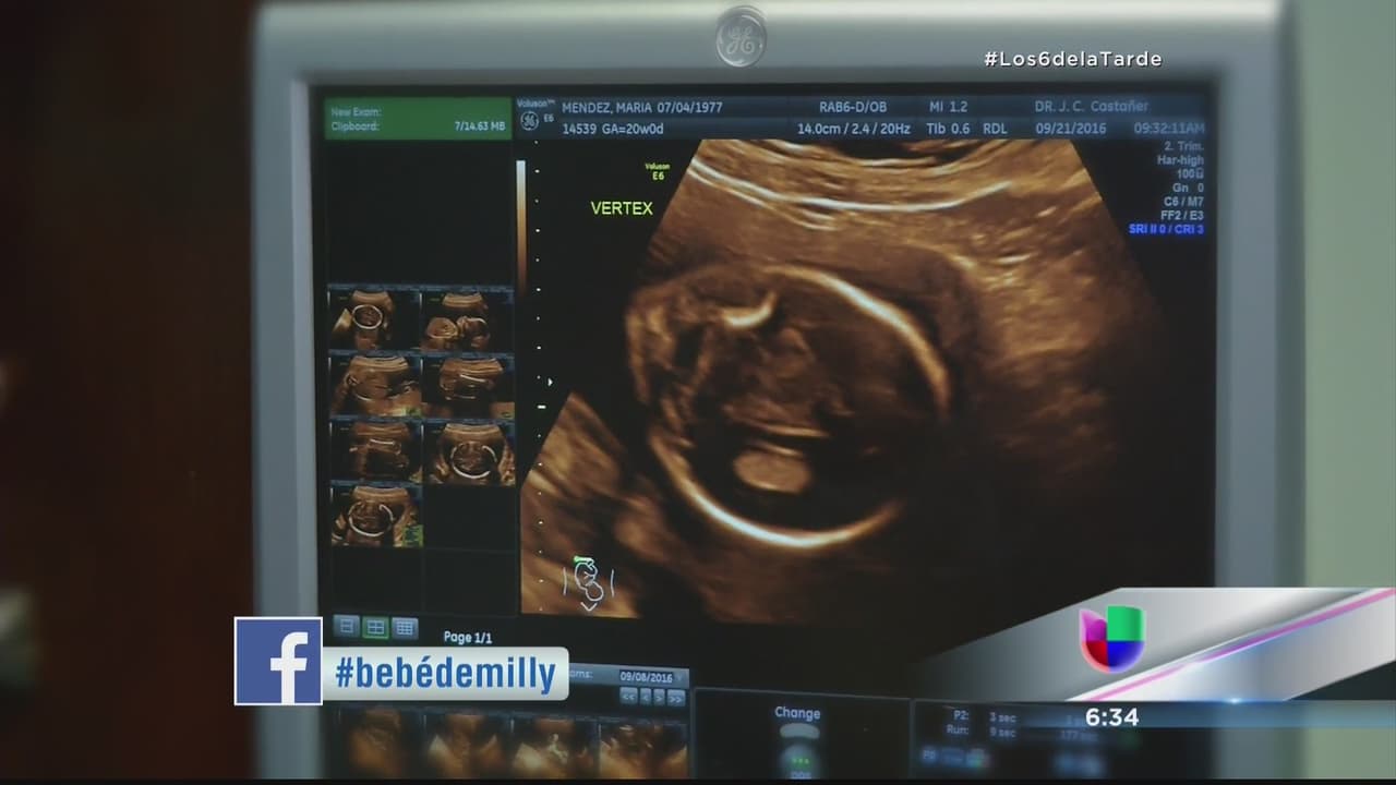 Sonograma de Milly Méndez