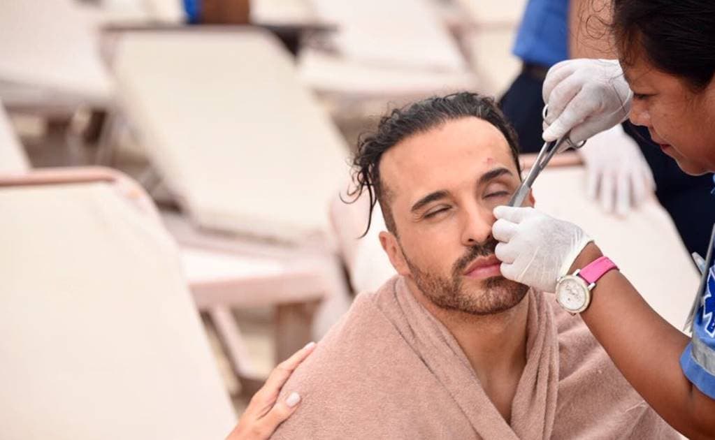 La cortada que sufrió 'Apio' Quijano, requirió de atención imnediata y de cuatro puntas, según informó su staff.