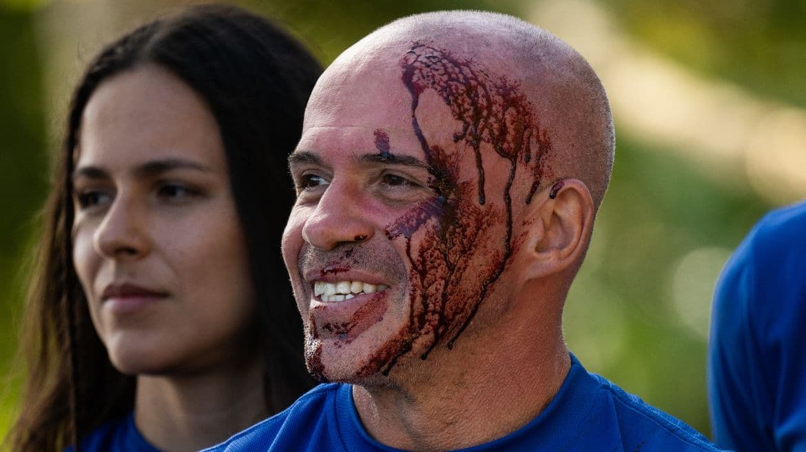 Richie fue marcado por las Amazonas