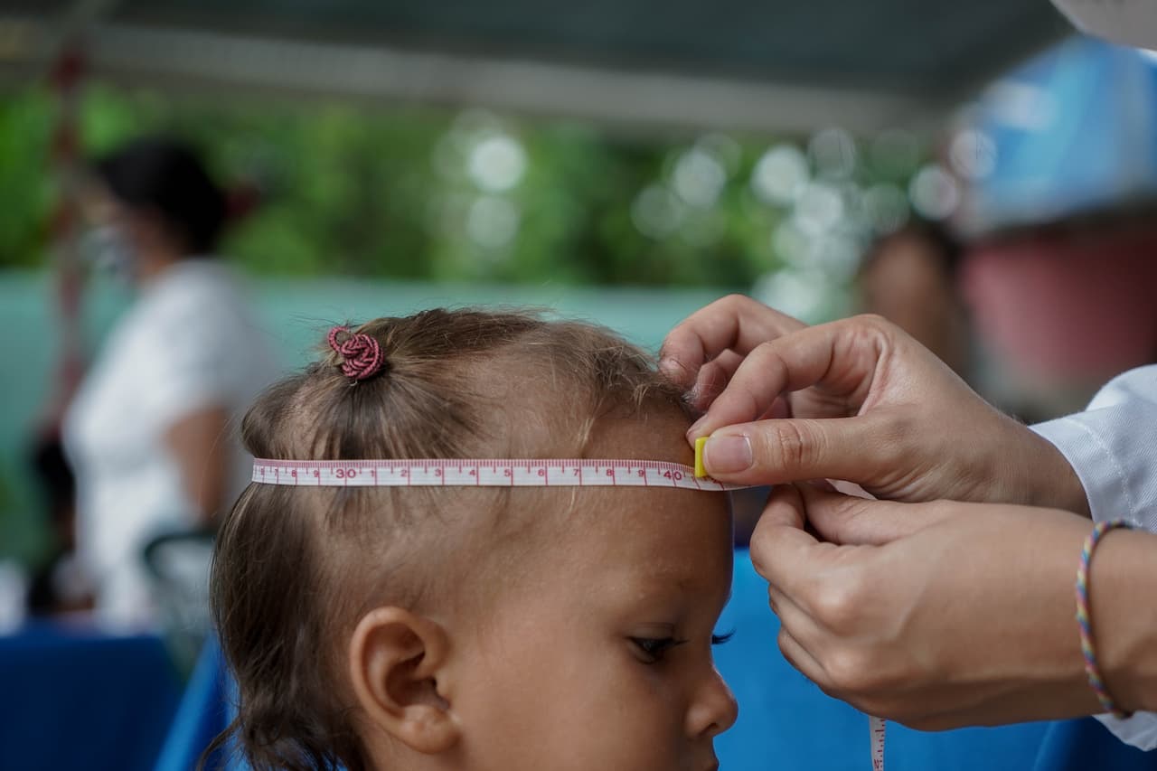 Los pediatras miden y pesan a los niños para diagnosticar la desnutrición.