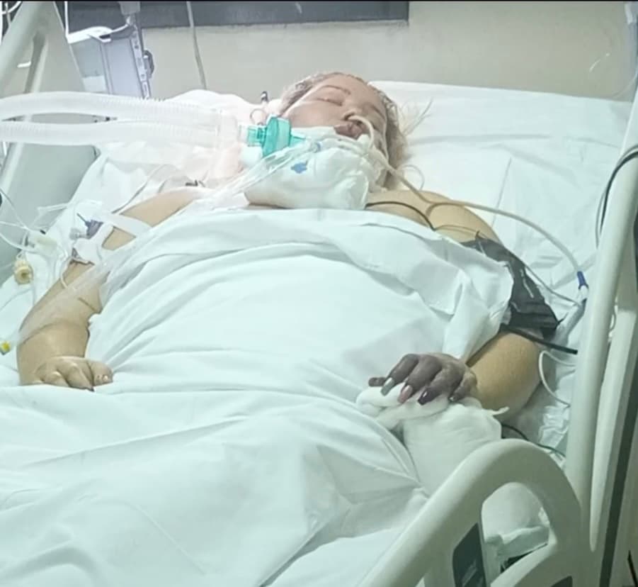 Después de explicarle que había pasado 4 semanas intubada y en terapia intensiva, de pronto aquella maestra venezolana de 49 años sintió una molestia en sus pies y le pidió ayuda a su hija. 
<br>