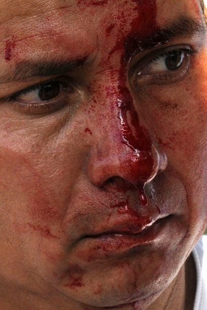 En tanto, la Comisión Interamericana de Derechos Humanos (CIDH) solicitó que Honduras expliqué actos de hostigamiento institucional dirigidos a organizaciones de defensa de los derechos humanos, según grupos de activistas.