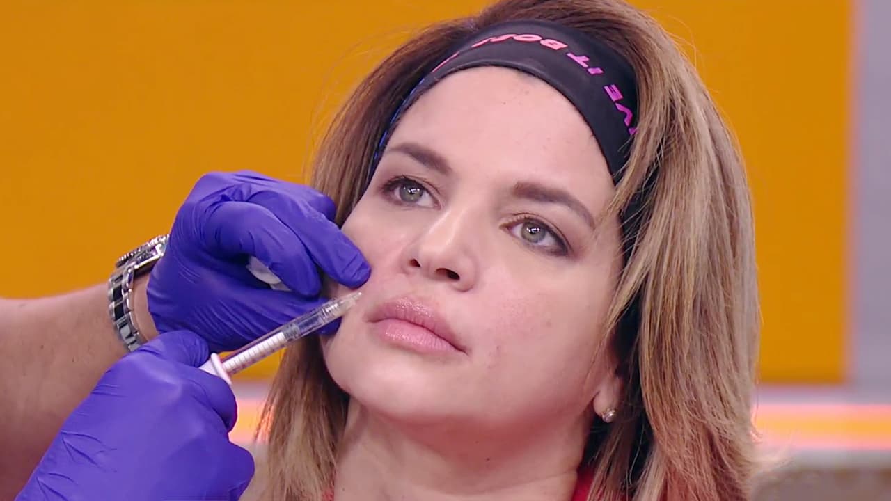 ¿Te gustaría tener una sonrisa sin arrugas? Este sencillo tratamiento con ácido hialurónico te ayudará a lograrlo