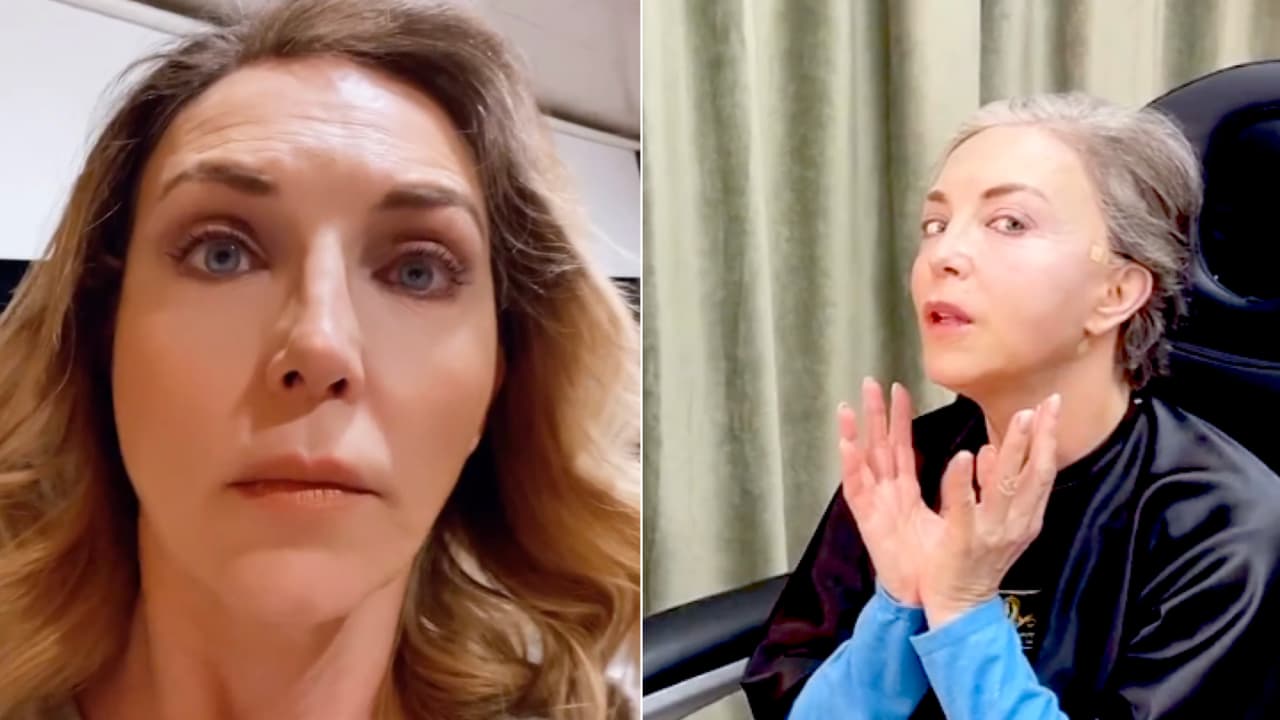 Le dicen a Laura Flores que le quedó "una mejilla más inflamada" por los hilos tensores y así reaccionó