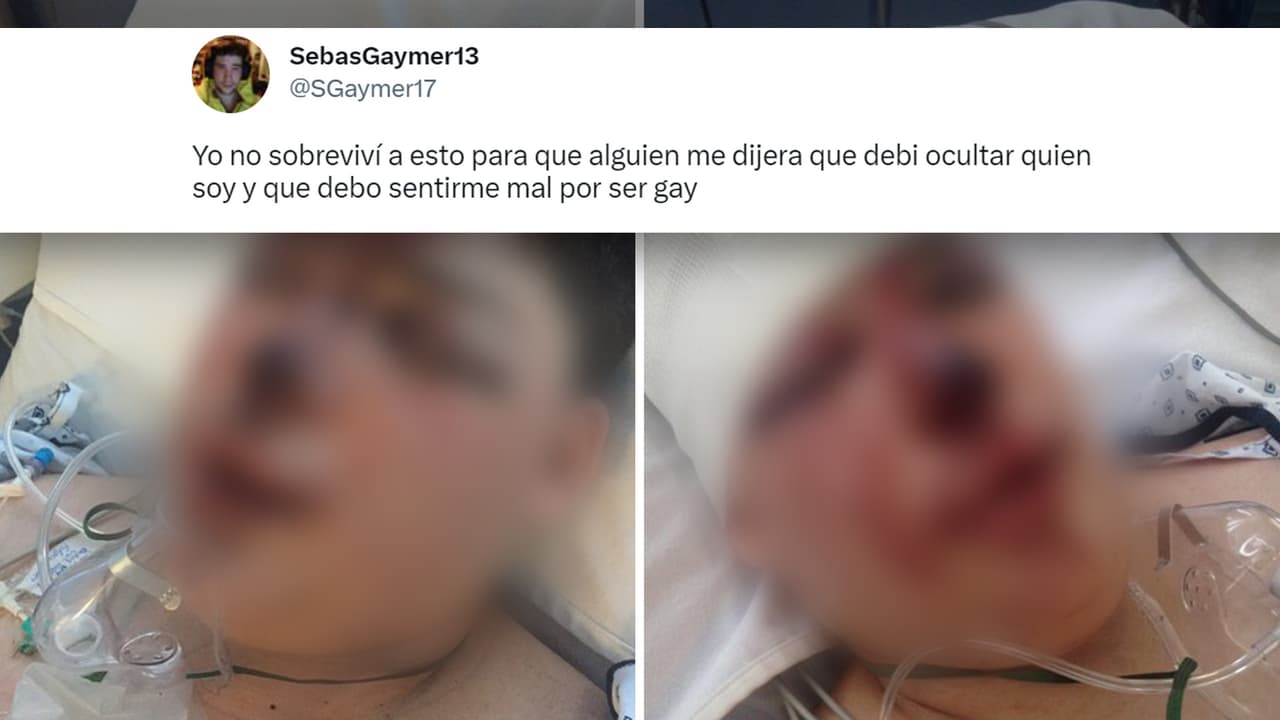Estas fueron las fotos que compartió Sebastián Adame y que causaron preocupación entre sus seguidores.