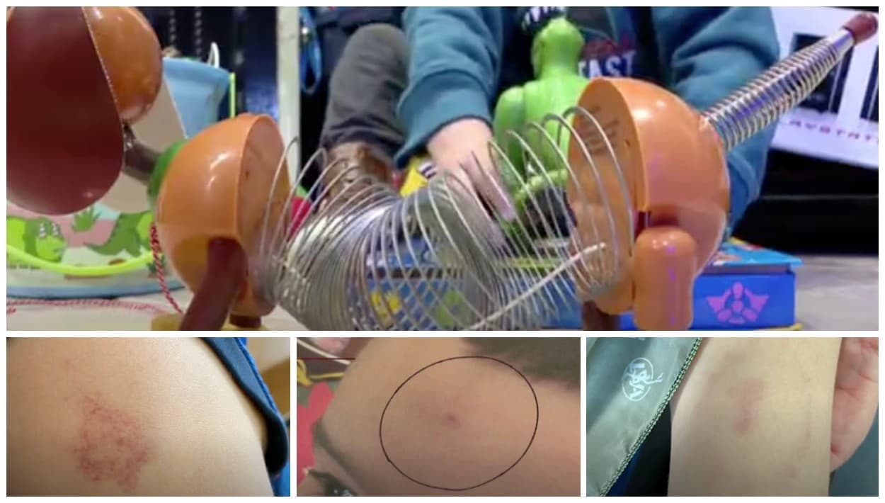 Niño de 5 años tiene miedo de ir a escuela en Los Ángeles, de donde llegó con moretones y mordidas