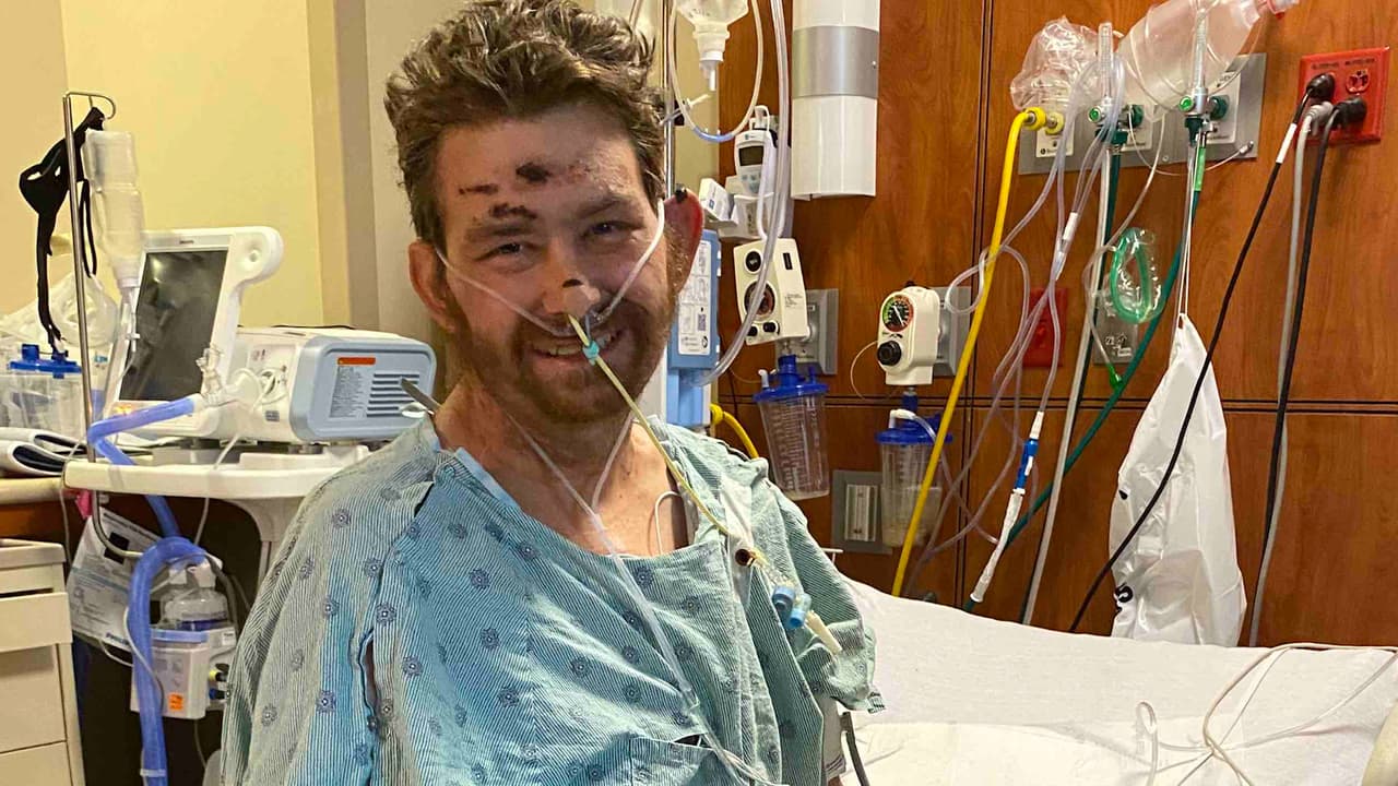 Un vello encarnado dejó a este hombre en coma y con pocas expectativas de sobrevivir