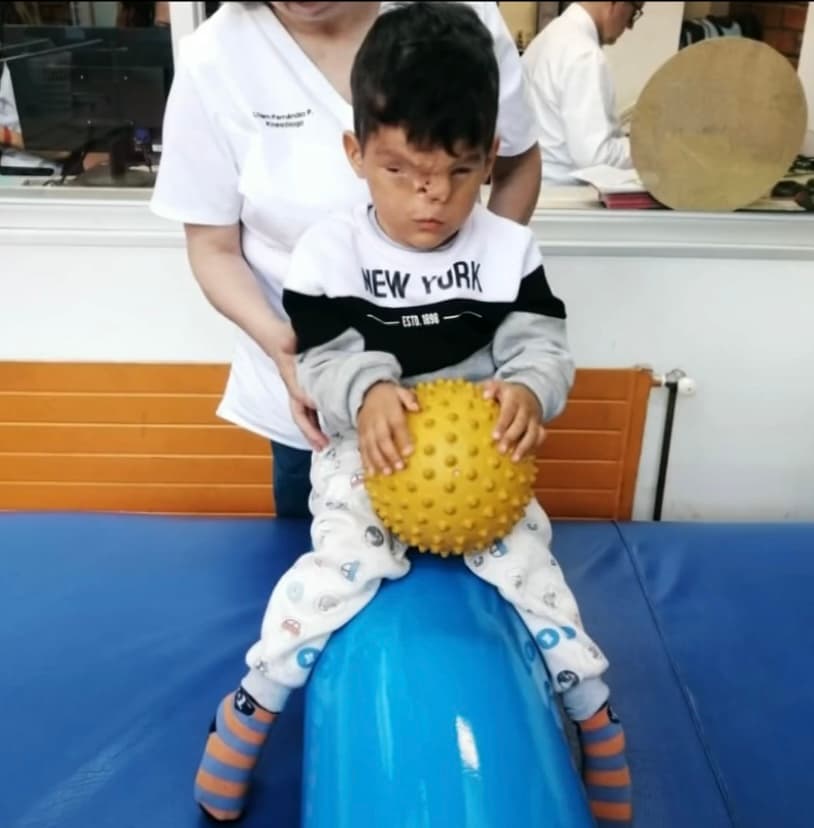 Sin embargo, en medio de esa búsqueda por una solución que le pueda dar a su hijo una apariencia normal, Luna también ha aprendido mucho de la batalla interna de su niño, a quien considera como 
<b>“el corazón que unió a toda una familia, amigos y conocidos, por el ejemplo de valentía que nos ha dado”. </b>
<br>