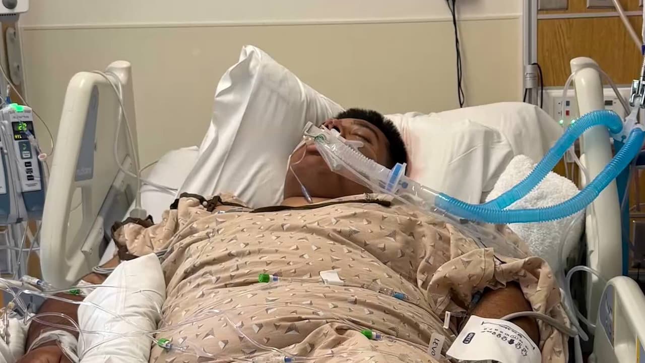 Palmera cae sobre joven y su familia teme que quede paralizado permanentemente