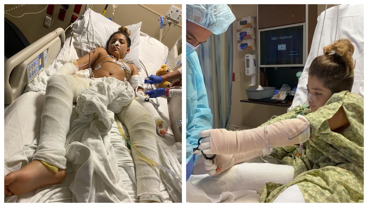 "Fue aterrador y doloroso": niño se arrepiente después de quemarse haciendo un reto de TikTok