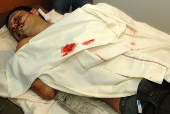 Honduras terminó 2010 considerado como el país más violento de Centroamérica tras registrar alrededor de seis mil 236 asesinatos, cifra que superó a la de 2009 en mil 240 muertes violentas.