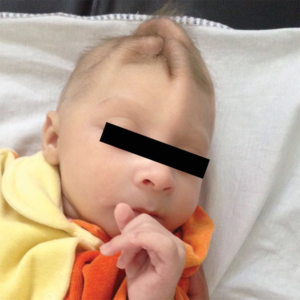 La madre de este bebé dio a luz a los 20 años y no tuvo ningún tipo de síntomas o erupción durante el embarazo.