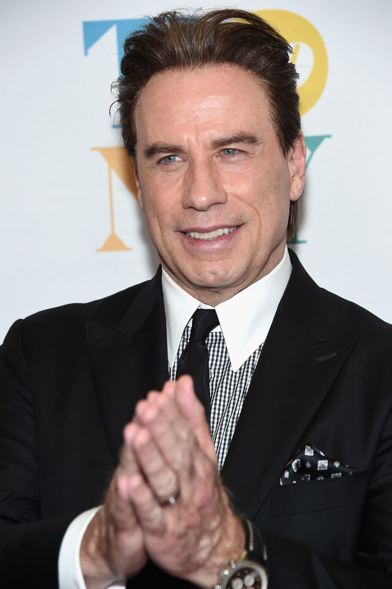 Pero en ocasiones la protuberancia de su frente dejaba ver una pérdida de cabello y era notoria la presencia de un peluquín para ocultarlo.