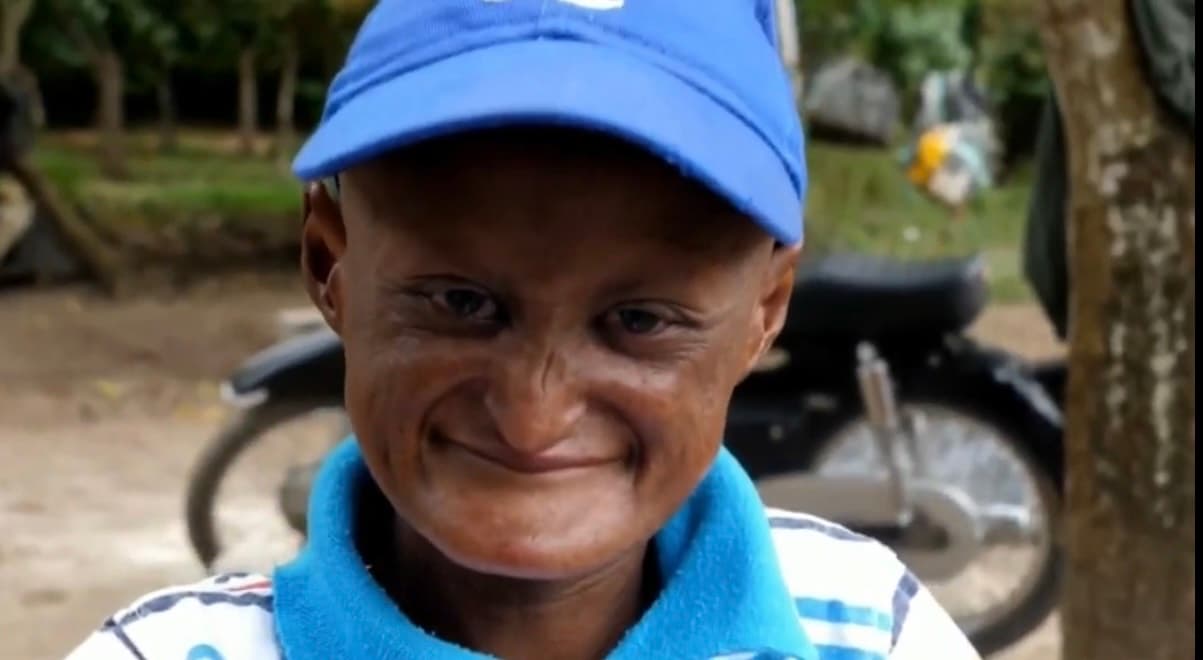 <b>"Es el más lindo de la casa y le pido a dios que me dé fuerza y valor para luchar con el"</b>, implora Elvira su madre, mientras él no para de sonreír a pesar de la inminente desesperación que hay en su hogar.