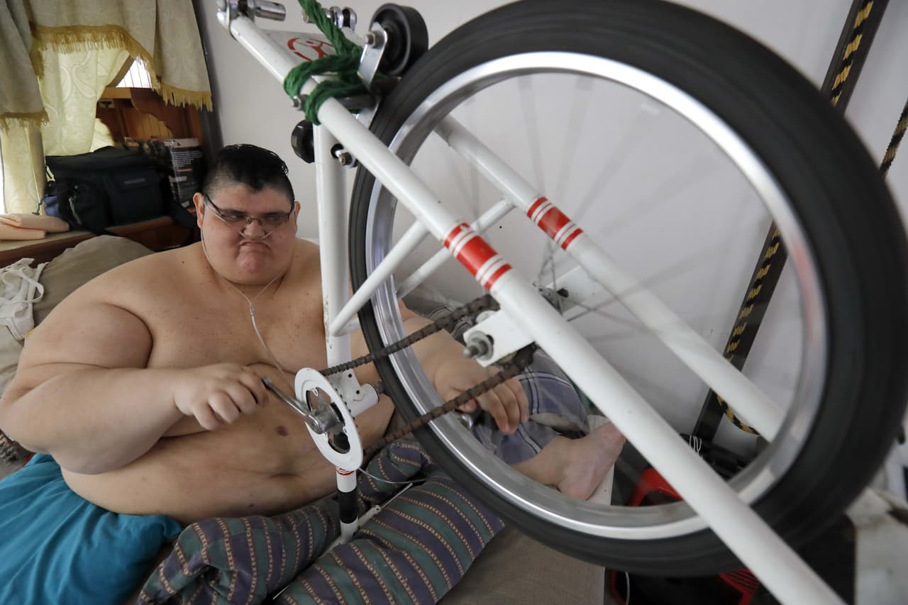 Para el equipo médico interdisciplinario, "sigue siendo un paciente complejo y seguirá en riesgo hasta que deje de ser una persona con
<a href="https://www.univision.com/temas/obesidad">obesidad</a> extrema". En la clínica le hacen un seguimiento cercano, pues
<b>su vida aún está en riesgo</b>.