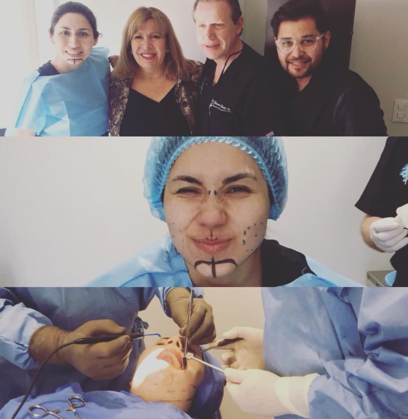 Meses después de su incursión en el programa mexicano 'Enamorándonos', que es su debut en la pantalla chica, 'Bebeshita' decidió someterse a su primera cirugía.