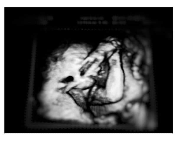 La actriz tiene casi ocho meses de embarazo, su esposo Alberto Guerra compartió el ultrasonido de la pequeña Lúa.