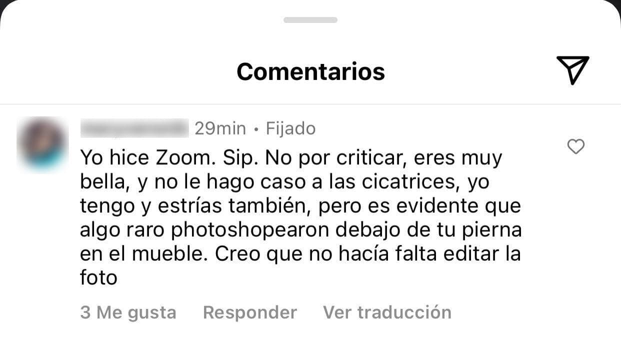 Sin embargo, hubo quien le dijo que era "evidente" que la imagen la
<b> "'photoshopearon' debajo de la pierna",</b> justo en la cicatriz: "No hacía falta editar la foto", le escribió una seguidora. 
<br>