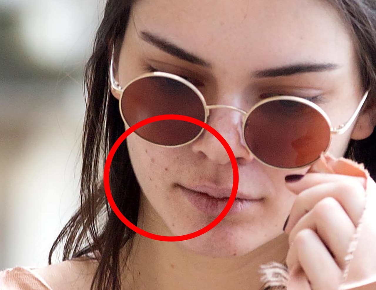 Los paparazzi captaron el acné de la hermana de Kim Kardashian.