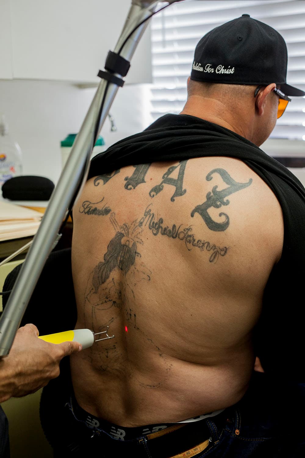 La remoción de tatuajes es un proceso costoso. Borrar un tatuaje de gran tamaño puede costar miles de dólares. En Sunrise Center se ofrece este proceso de manera gratuita o con pagos casi simbólicos.