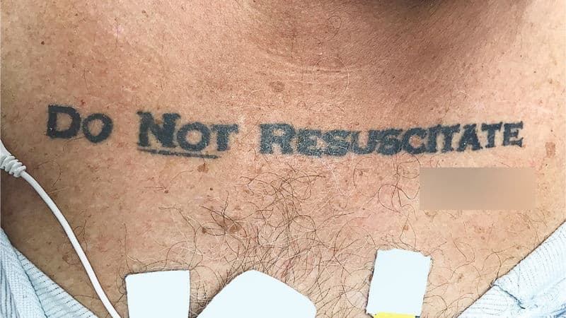 Qué hacer con un hombre que llega inconsciente al hospital con un tatuaje que dice "no resucitar"