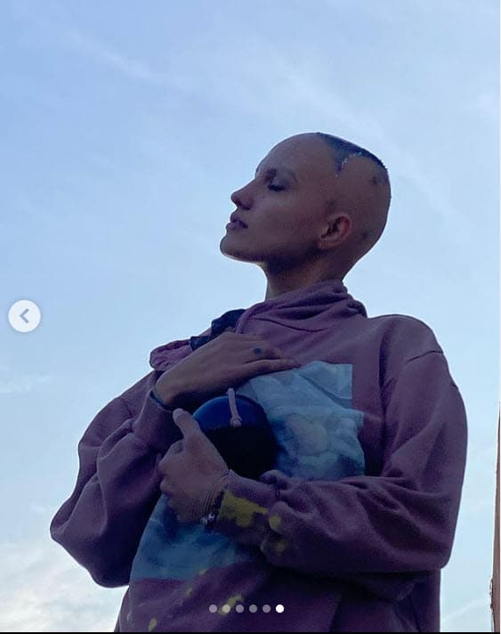 La institución afirma que 
<b>"es diferente para cada persona"</b>. En algunas, "el pelo vuelve a crecer por completo, mientras que en otras no" y "no existe una cura".
<br>