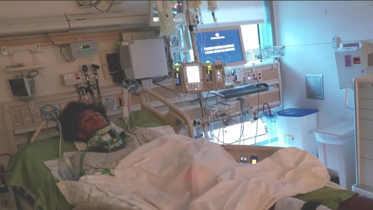 "Entrégate por favor": buscan al sospechoso de atropellar y dejar grave a un joven en Hollywood Hills