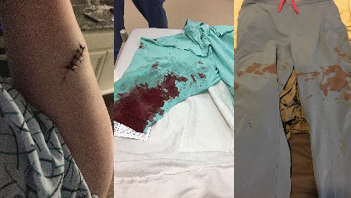 Denuncian agresión con cuchillo e insultos racistas a una enfermera musulmana en Houston