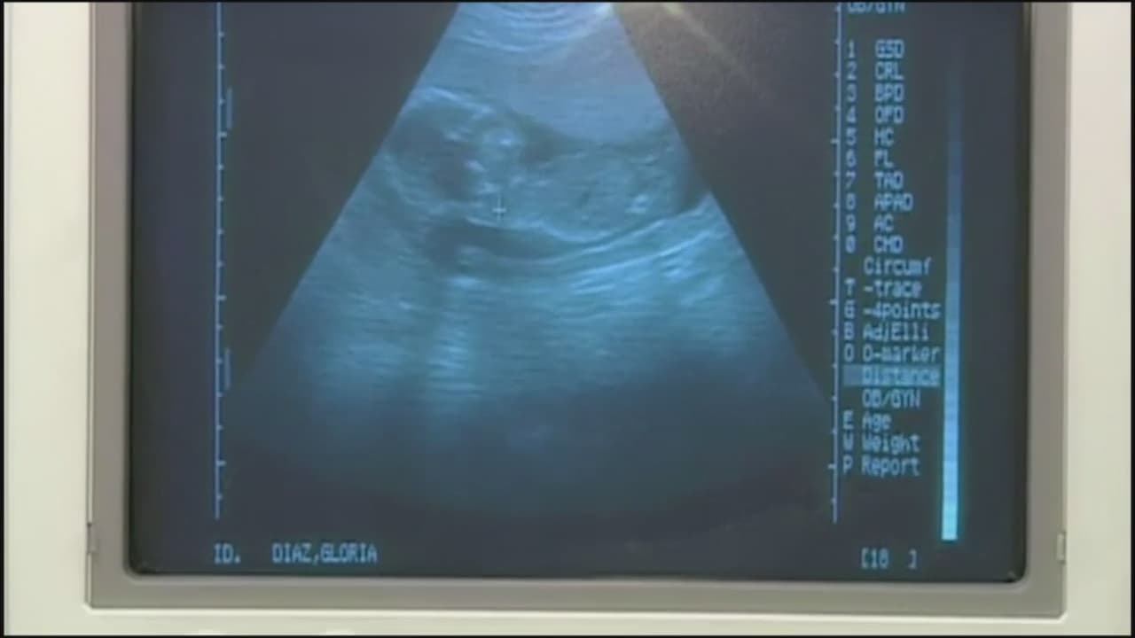 Juez federal bloquea temporalmente entrada en vigencia de ley que restringe abortos en Georgia