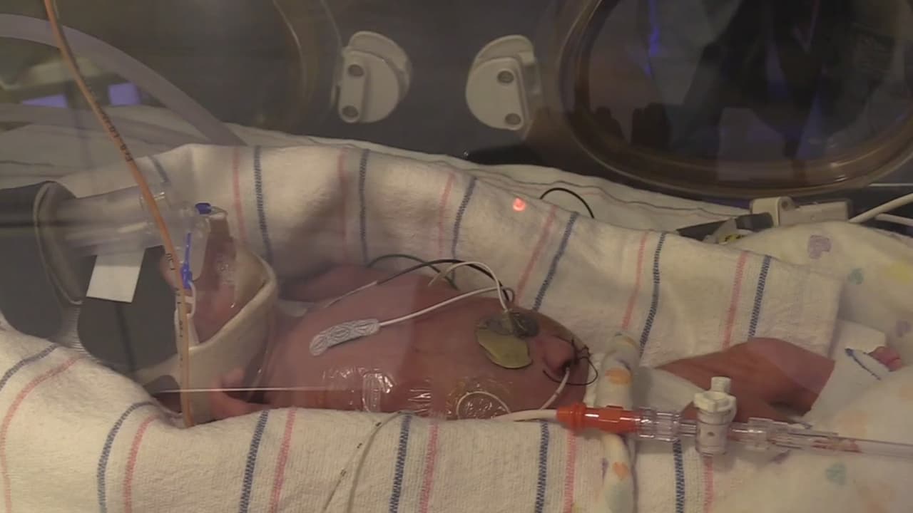 En este hospital 10 mujeres dan a luz a trillizos y mellizos en las últimas semanas