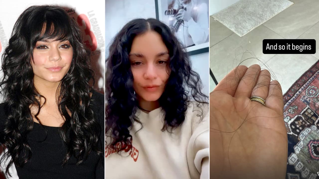 Vanessa Hudgens está perdiendo el pelo tras embarazo: esto padece