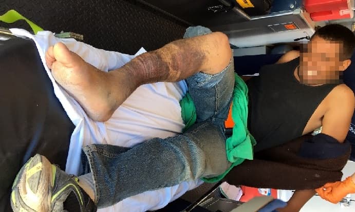 Rescatan a inmigrante mexicano herido en la frontera