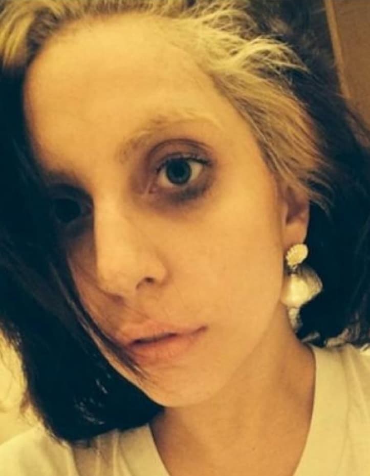 ¿Miedo? No, es Lady Gaga sin maquillaje. Pareciera que lleva mil noches sin dormir.