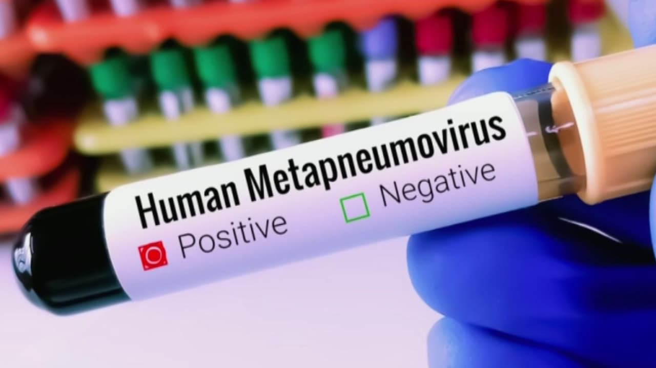 Virus respiratorio sin vacuna se propaga en EEUU; California y Nueva Jersey entre los más afectados