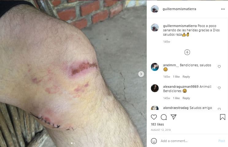 Tapia comentó a Univision Entretenimiento el mismo día del accidente: “Sólo vi que invadió mi carril, fue en un segundo, de repente yo ya tenía el coche encima, él iba muy rápido, yo volanteé pero no fue suficiente”.