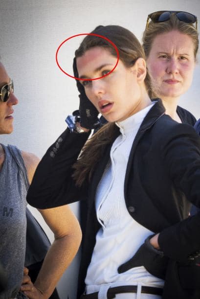 ¡Qué alivio! Así evitó recibir todo el impacto en la cabeza.