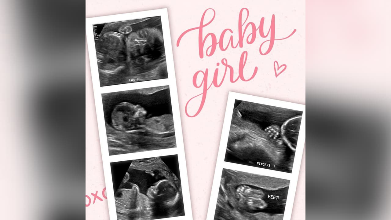 “Yo sabía que, si yo dejaba que esta
<b><a href="https://www.univision.com/local/houston-kxln/yo-no-sabia-que-hay-gente-tan-buena-en-este-mundo-madre-que-vive-en-su-auto-con-sus-hijos-ante-ayuda-recibida">enfermedad</a></b> siguiera, yo me iba a morir, yo nada más decía que no quería morirme sin volver a ver a mi familia”, continuó Reyes.