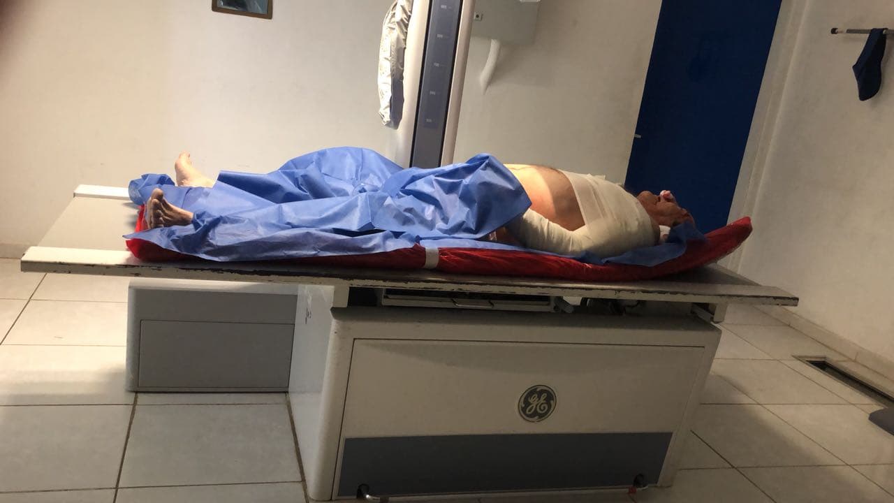 Don Miguel Angulo fue uno de los músicos que resultó más lesionado por lo que tuvo que ser trasladado en ambulancia a la ciudad de Culiacán, Sinaloa (al noroeste de la República Mexicana), donde tendrá que ser intervenido quirúrgicamente.