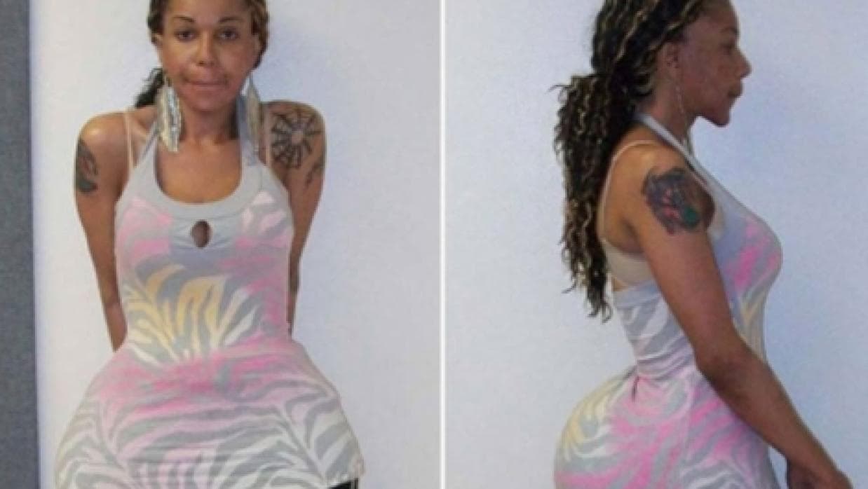 28 de marzo. Condenan a 10 años de prisión por homicidio culposo a la falsa médica de Florida que inyectaba cemento en los glúteos de sus pacientes. Oneal Ron Morris aplicaba en los cuerpos de mujeres fórmulas compuestas de cemento, aceite mineral, silicona, pegamento o sellador de llantas, entre otros productos tóxicos. Una de ellas murió en 2012 debido a complicaciones relacionadas con estas peligrosas prácticas.
<a href="http://www.univision.com/miami/wltv/noticias/condenas/condenan-a-10-anos-de-prision-por-homicidio-culposo-a-la-falsa-medica-de-florida-que-inyectaba-cemento-en-gluteos"><b>Conoce más de su historia aquí.</b></a>