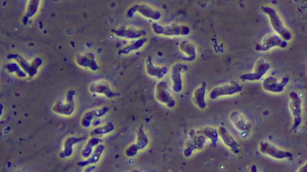 Intenso calor de Florida aumenta el riesgo de la "ameba come cerebros"