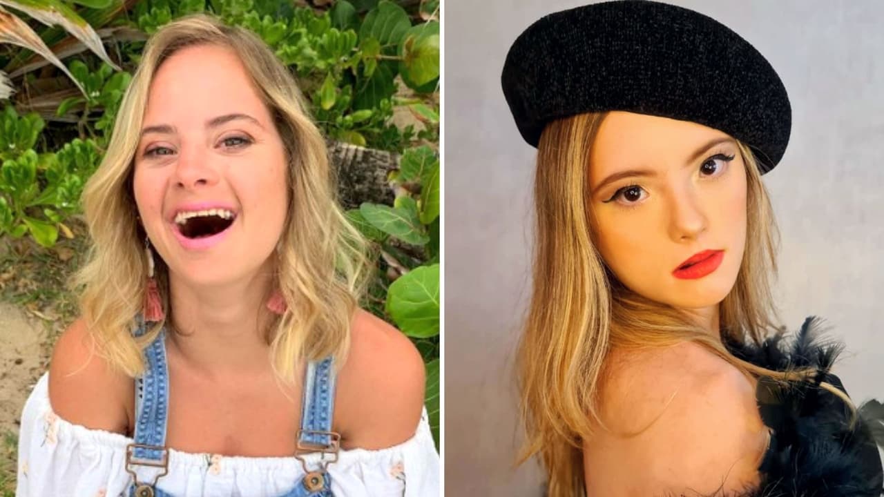 7 modelos con Síndrome de Down que conquistan las pasarelas: una debutó en Victoria's Secret