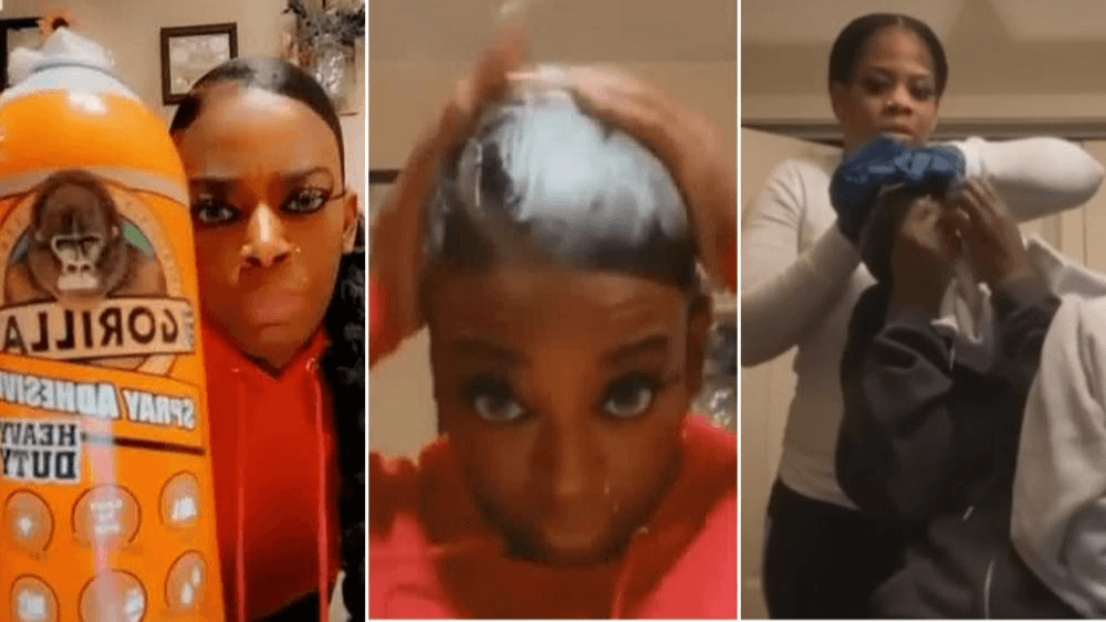 La mujer del Gorilla Glue es intervenida sin costo alguno para quitarle el pegamento del cabello