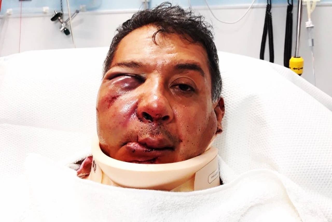 Oswaldo Refugio Sánchez, padre de tres hijos, salió como de costumbre a las calles de la zona de Marina del Rey, 
<b>entre las calles Lincoln y Maxella, para vender flores, cuando <a href="https://www.univision.com/local/los-angeles-kmex/me-dijo-que-me-iba-a-matar-vendedor-de-flores-queda-inconsciente-tras-ataque-con-objeto-de-metal-para-robarle">fue atacado por un afroestadounidense con un objeto de metal</a>. </b>