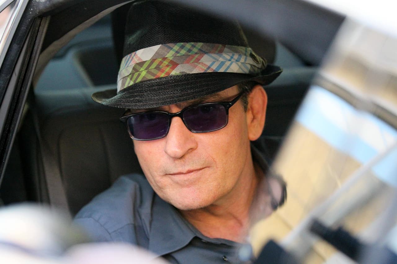 Charlie se ha acostumbrado a vivir con este padecimiento.