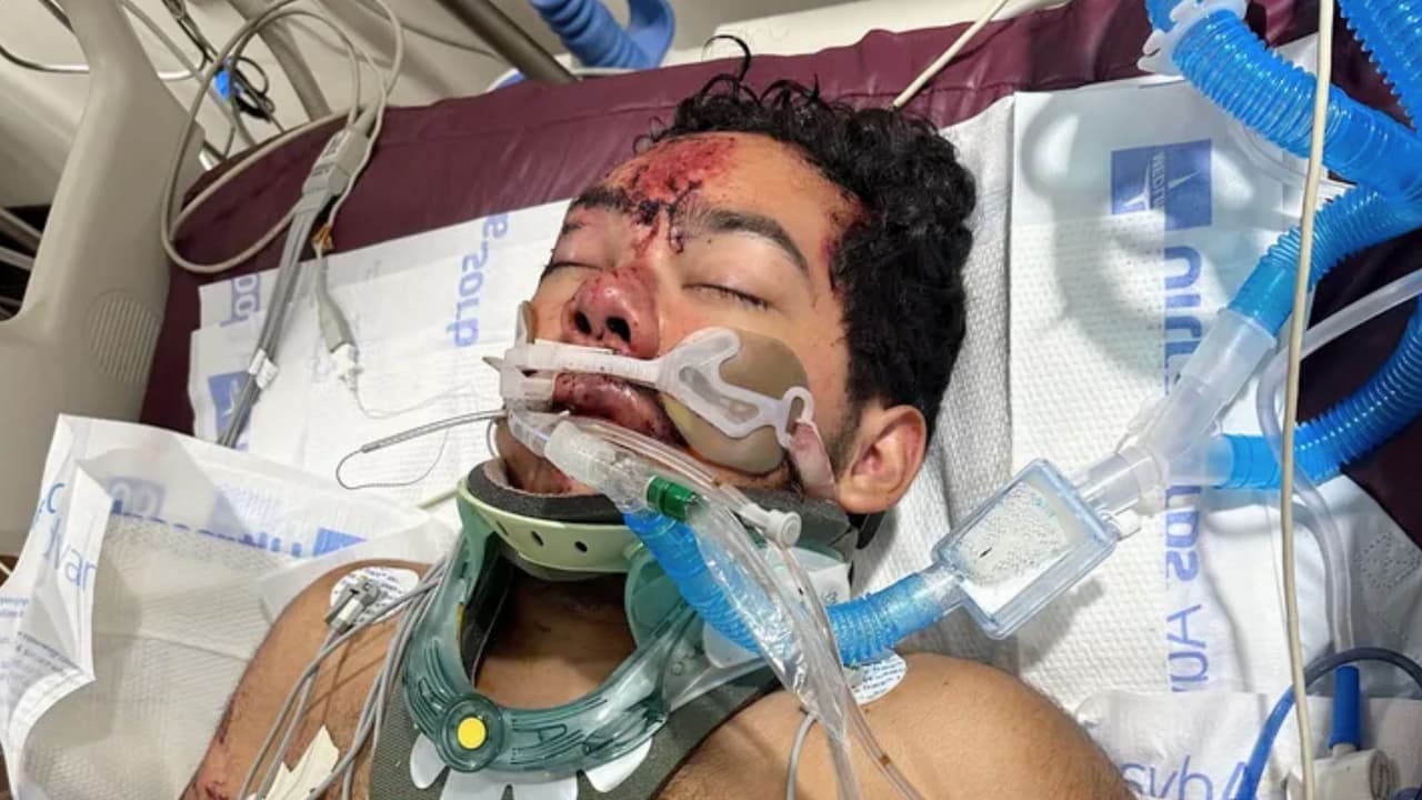 Anthony Rosales permanece en la Unidad de Cuidados Intensivos de un hospital en el norte de Texas, tras un accidente que cobró la vida de sus padres y dos de sus hermanos.