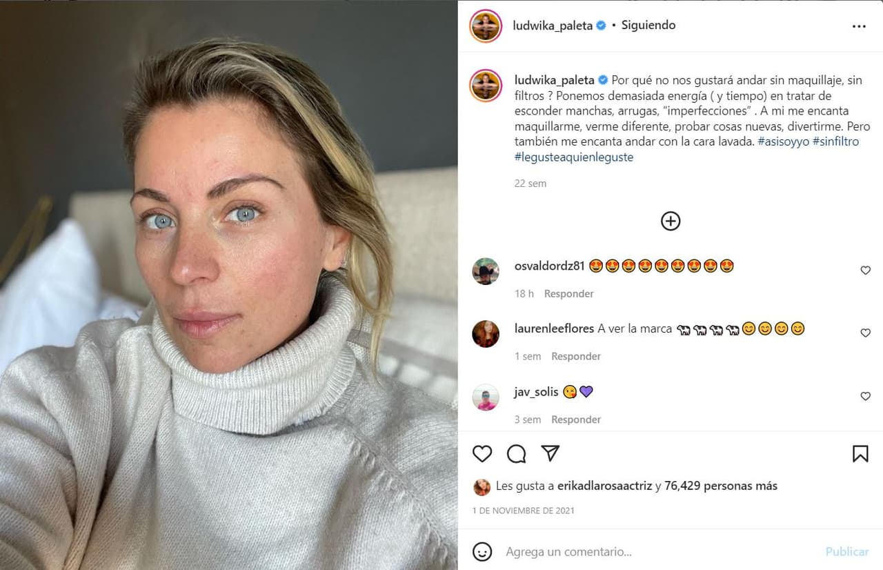 Apostar por su belleza al natural, sin gota de maquillaje o filtros, es algo que Ludwika defiende y constantemente comparte sus ideas sobre el tema en Instagram.