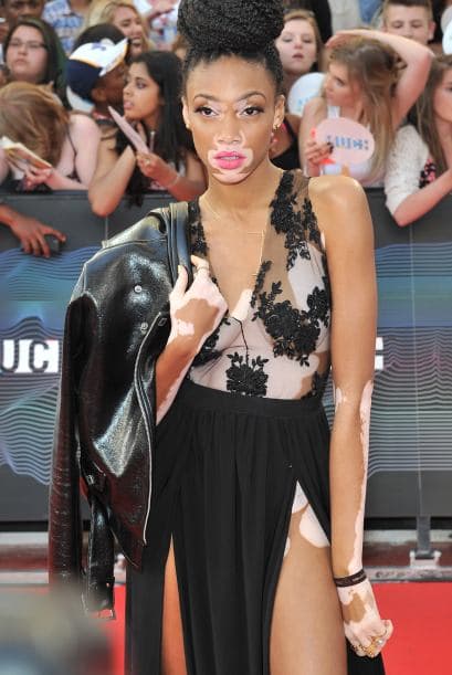 Su condición la ha colocado como un ejemplo a seguir para muchas mujeres, y sobre todo, un nuevo canon de belleza.