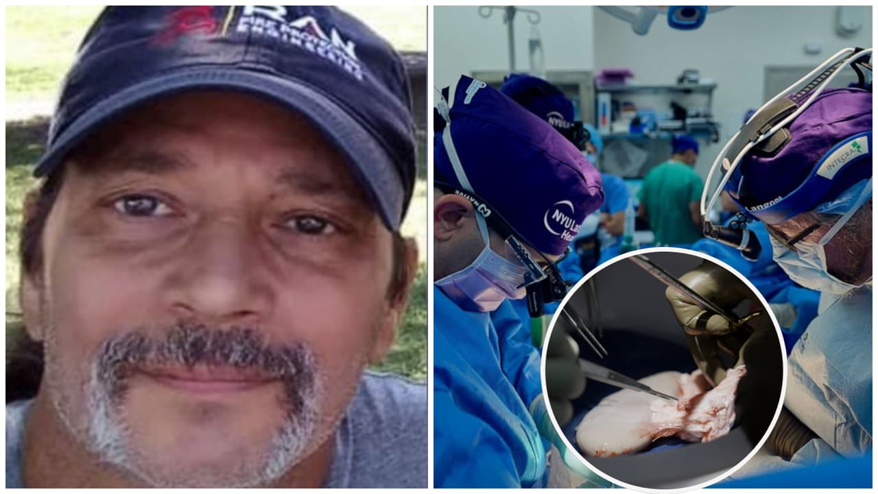 “Va a estar en los libros de medicina": Riñón de cerdo trasplantado a paciente con muerte cerebral funciona durante un mes