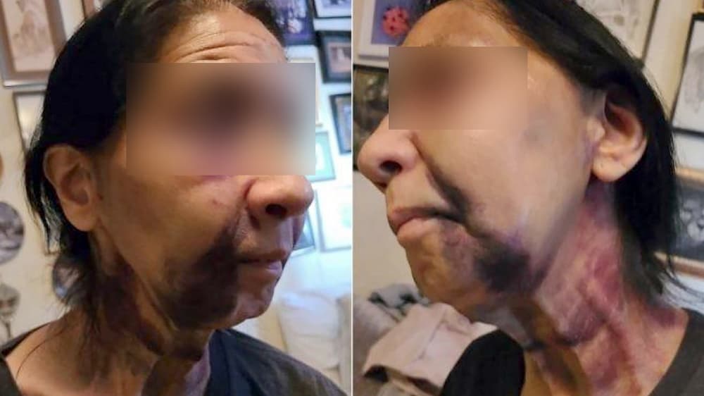 Golpean brutalmente a una anciana de origen mexicano que pensaron era asiática, denuncia su hijo