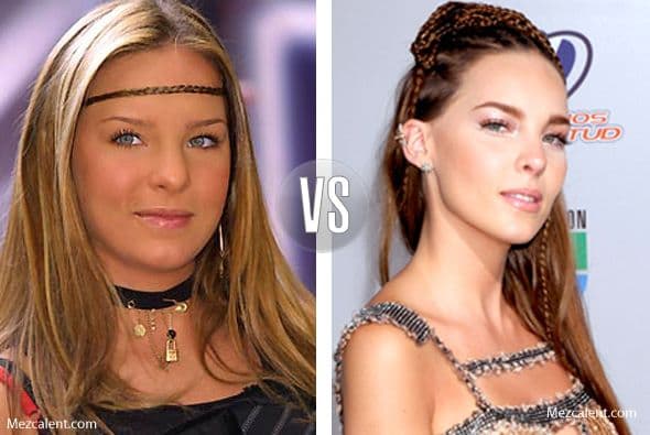 Belinda no lo niega, se operó la nariz, ¿y qué? Sigue siendo bella. La cantante ha recurrido al quirófano para arreglársela en dos ocasiones.